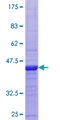Cystatin SA / CST2 Protein - 12.5% SDS-PAGE of human CST2 stained with Coomassie Blue