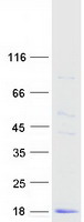 Cystatin SA / CST2 Protein - Purified recombinant protein CST2 was analyzed by SDS-PAGE gel and Coomassie Blue Staining