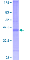 CYSTM1 / C5orf32 Protein - 12.5% SDS-PAGE of human ORF1-FL49 stained with Coomassie Blue