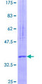 CYSTM1 / C5orf32 Protein - 12.5% SDS-PAGE of human ORF1-FL49 stained with Coomassie Blue