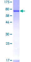 CYTH1 / Cytohesin-1 Protein - 12.5% SDS-PAGE of human PSCD1 stained with Coomassie Blue