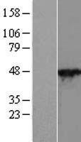 CYTH2 / Cytohesin 2 Protein - Western validation with an anti-DDK antibody * L: Control HEK293 lysate R: Over-expression lysate