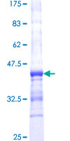 CYTH2 / Cytohesin 2 Protein - 12.5% SDS-PAGE Stained with Coomassie Blue.