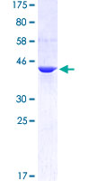 CYTH3 / GRP1 Protein - 12.5% SDS-PAGE of human CYTH3 stained with Coomassie Blue