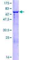CYTH3 / GRP1 Protein - 12.5% SDS-PAGE of human PSCD3 stained with Coomassie Blue