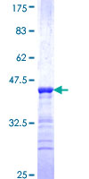 CYTH4 / PSCD4 Protein - 12.5% SDS-PAGE Stained with Coomassie Blue