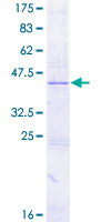 CYTL1 / C17 Protein - 12.5% SDS-PAGE of human CYTL1 stained with Coomassie Blue