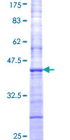 CYTL1 / C17 Protein - 12.5% SDS-PAGE Stained with Coomassie Blue.