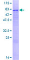 Cytochrome P450 2R1 / CYP2R1 Protein - 12.5% SDS-PAGE of human CYP2R1 stained with Coomassie Blue