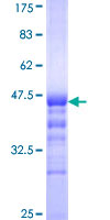 Cytokine IK Protein - 12.5% SDS-PAGE Stained with Coomassie Blue.
