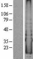 CYYR1 Protein - Western validation with an anti-DDK antibody * L: Control HEK293 lysate R: Over-expression lysate