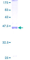 D2HGDH Protein - 12.5% SDS-PAGE Stained with Coomassie Blue