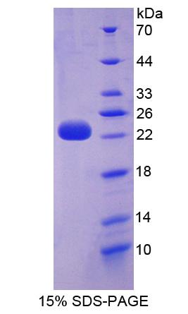 D2HGDH Protein - Recombinant D2-Hydroxyglutarate Dehydrogenase By SDS-PAGE