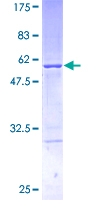 D52 / TPD52 Protein - 12.5% SDS-PAGE of human TPD52 stained with Coomassie Blue