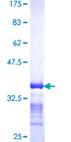 D52 / TPD52 Protein - 12.5% SDS-PAGE Stained with Coomassie Blue.