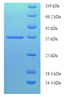 D52 / TPD52 Protein