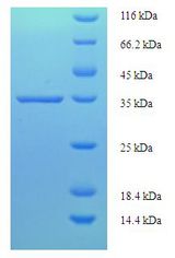 D52 / TPD52 Protein