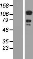 DAAM1 Protein - Western validation with an anti-DDK antibody * L: Control HEK293 lysate R: Over-expression lysate