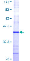 DAAM1 Protein - 12.5% SDS-PAGE Stained with Coomassie Blue.