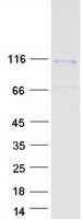 DAAM1 Protein - Purified recombinant protein DAAM1 was analyzed by SDS-PAGE gel and Coomassie Blue Staining