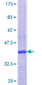 DAAM2 Protein - 12.5% SDS-PAGE of human DAAM2 stained with Coomassie Blue