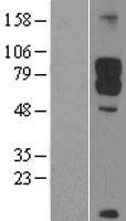 DAB1 Protein - Western validation with an anti-DDK antibody * L: Control HEK293 lysate R: Over-expression lysate