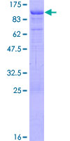 DAB1 Protein - 12.5% SDS-PAGE of human DAB1 stained with Coomassie Blue