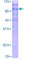 DAB2 Protein - 12.5% SDS-PAGE of human DAB2 stained with Coomassie Blue