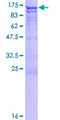 DAB2 Protein - 12.5% SDS-PAGE of human DAB2 stained with Coomassie Blue