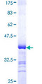 DAB2 Protein - 12.5% SDS-PAGE Stained with Coomassie Blue.