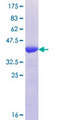 DAB2IP Protein - 12.5% SDS-PAGE Stained with Coomassie Blue.