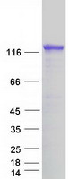 DAB2IP Protein - Purified recombinant protein DAB2IP was analyzed by SDS-PAGE gel and Coomassie Blue Staining