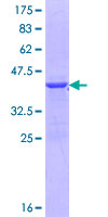 DACH / DACH1 Protein - 12.5% SDS-PAGE Stained with Coomassie Blue.