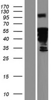 DACH2 Protein - Western validation with an anti-DDK antibody * L: Control HEK293 lysate R: Over-expression lysate