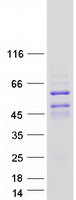 DACH2 Protein - Purified recombinant protein DACH2 was analyzed by SDS-PAGE gel and Coomassie Blue Staining