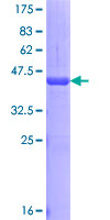 DACT1 / DAPPER Protein - 12.5% SDS-PAGE Stained with Coomassie Blue