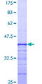 DAG1 / Dystroglycan Protein - 12.5% SDS-PAGE Stained with Coomassie Blue.