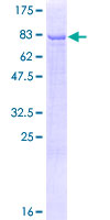 DALRD3 Protein - 12.5% SDS-PAGE of human DALRD3 stained with Coomassie Blue