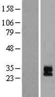 DAND5 Protein - Western validation with an anti-DDK antibody * L: Control HEK293 lysate R: Over-expression lysate
