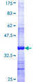 DAND5 Protein - 12.5% SDS-PAGE Stained with Coomassie Blue.