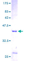 DAP Protein - 12.5% SDS-PAGE of human DAP stained with Coomassie Blue