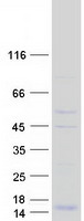 DAP10 Protein - Purified recombinant protein HCST was analyzed by SDS-PAGE gel and Coomassie Blue Staining