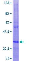 DAP12 Protein - 12.5% SDS-PAGE of human TYROBP stained with Coomassie Blue