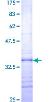 DAP12 Protein - 12.5% SDS-PAGE Stained with Coomassie Blue.