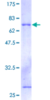 DAP3 Protein - 12.5% SDS-PAGE of human DAP3 stained with Coomassie Blue