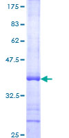 DAP3 Protein - 12.5% SDS-PAGE Stained with Coomassie Blue.