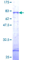 DAPK1 / DAP Kinase Protein - 12.5% SDS-PAGE of human DAPK1 stained with Coomassie Blue