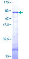 DAPK1 / DAP Kinase Protein - 12.5% SDS-PAGE of human DAPK1 stained with Coomassie Blue
