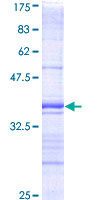 DAPK1 / DAP Kinase Protein - 12.5% SDS-PAGE Stained with Coomassie Blue.