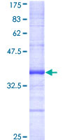 DAPK2 / DAP Kinase 2 Protein - 12.5% SDS-PAGE Stained with Coomassie Blue.